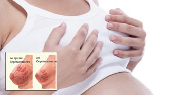 Как меняется грудь при беременности