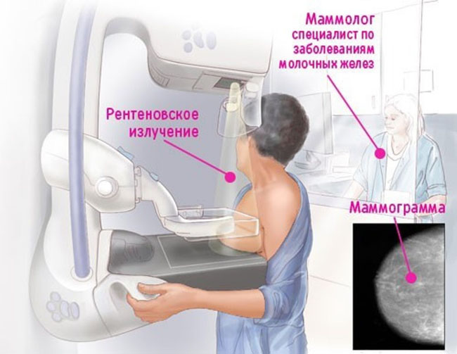 Маммография: методика
